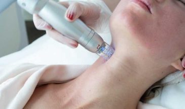 RF лифтинг на аппарате Infini — инновационный метод омоложения кожи