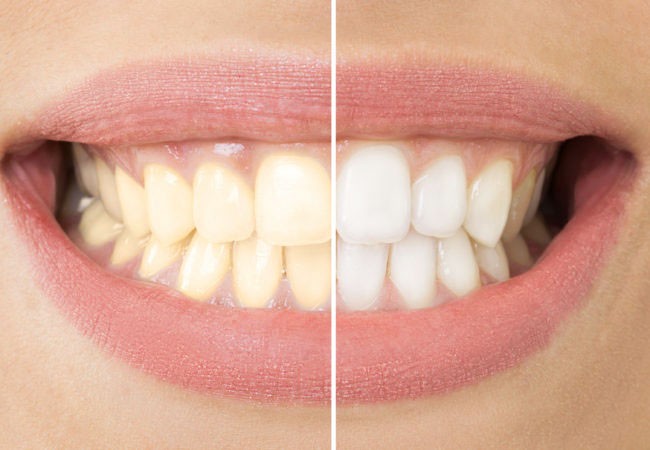 Красивые и здоровые зубы. Стоматология в Германии